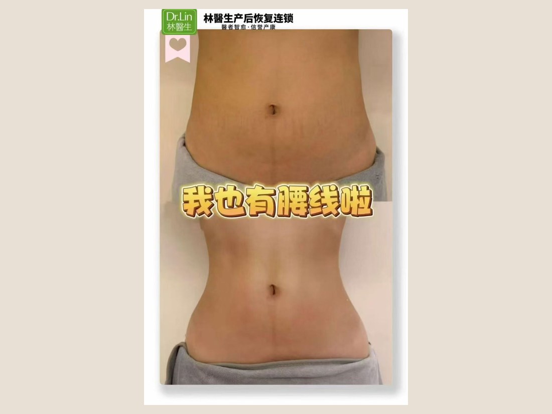 身材管理科部客户案例：我也有腰线啦
