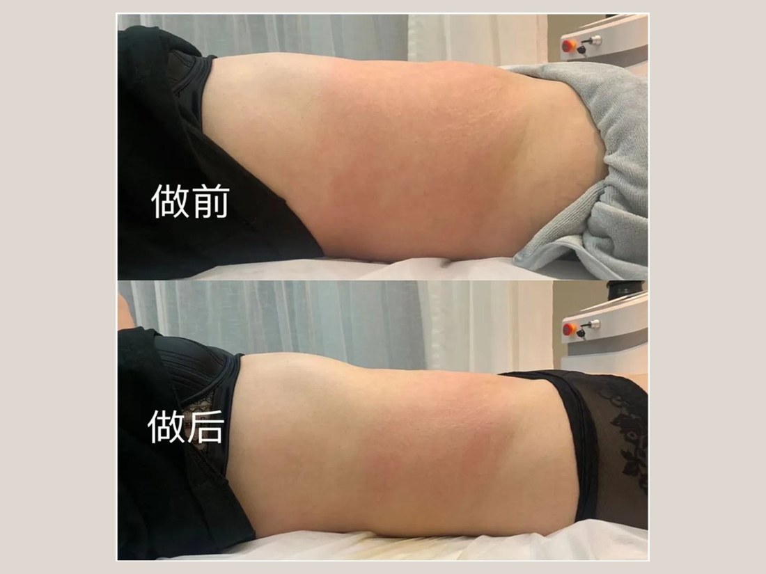 身材管理科部客户案例：GF 标准化细胞纤体