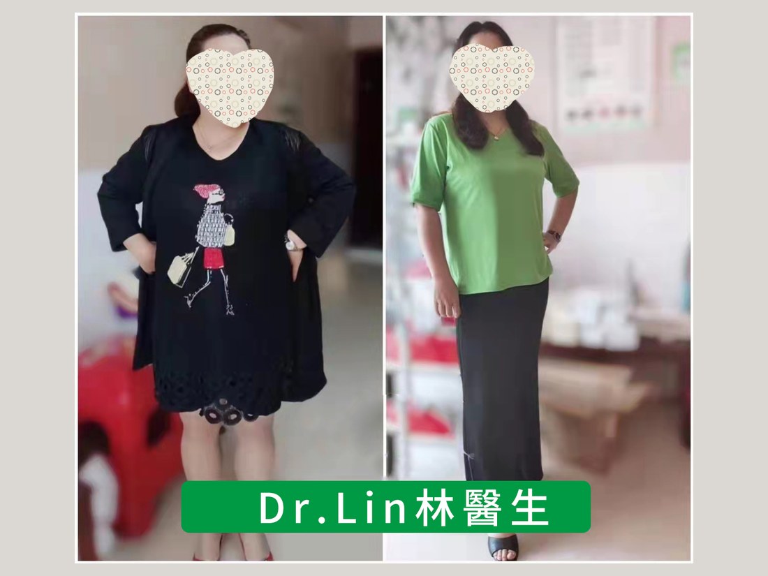 身材管理科部客户案例：产后体型调理前后对照