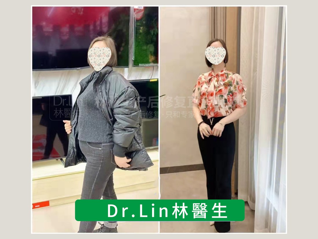 身材管理科部客户案例：产后体型调理前后对照