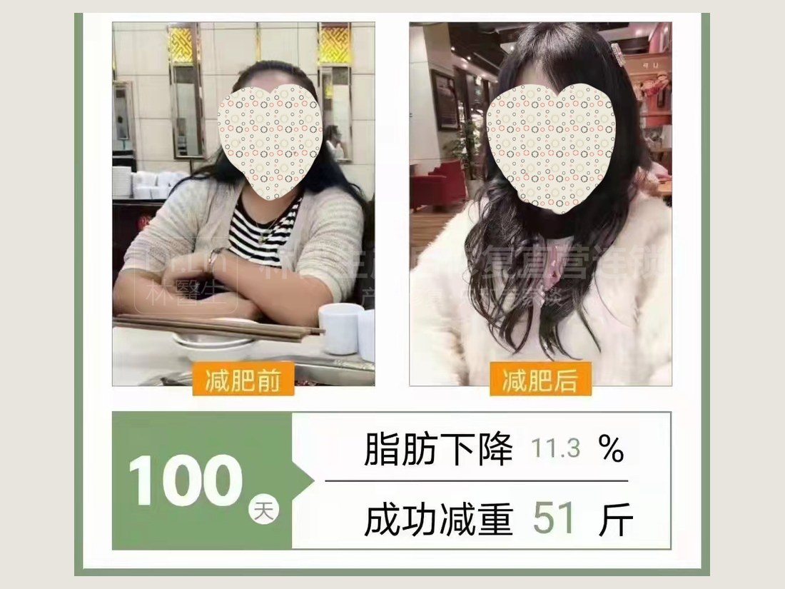 身材管理科部客户案例：100 天减重 51 斤