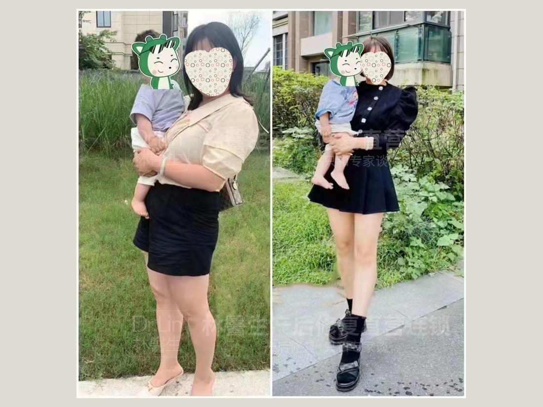 身材管理科部客户案例：抱娃体型前后对照