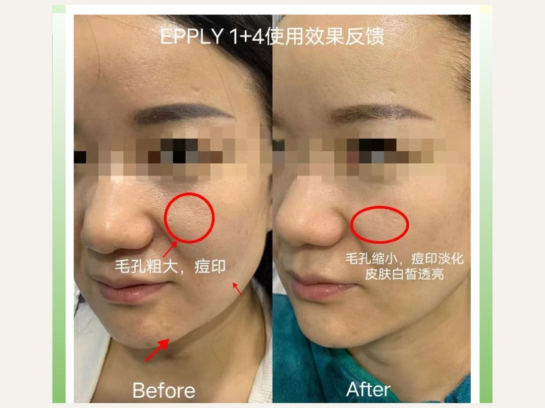 科技美肤部客户案例：基底再生