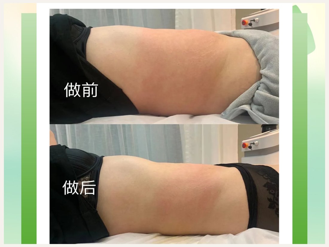 身材管理科部客户案例：GF 标准化细胞纤体
