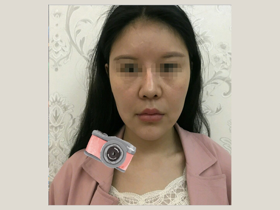 科技美肤部客户案例：面部状态实拍