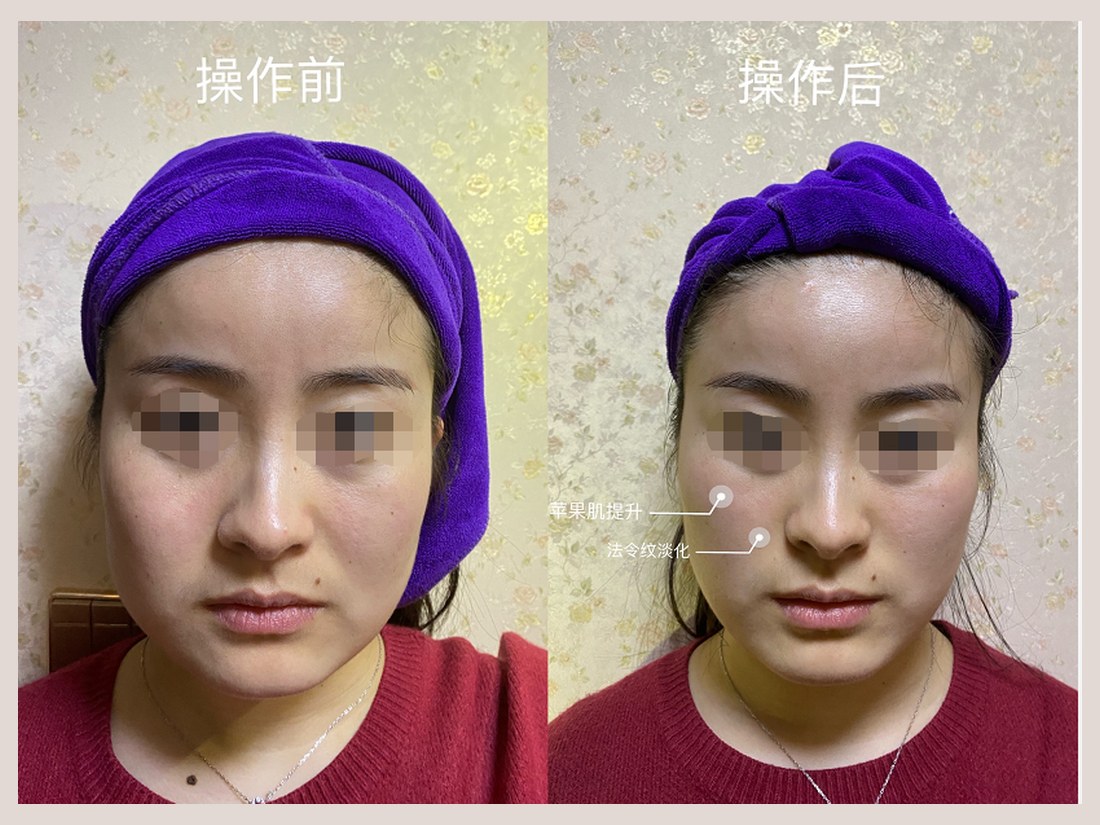 科技美肤部客户案例：操作前后对照