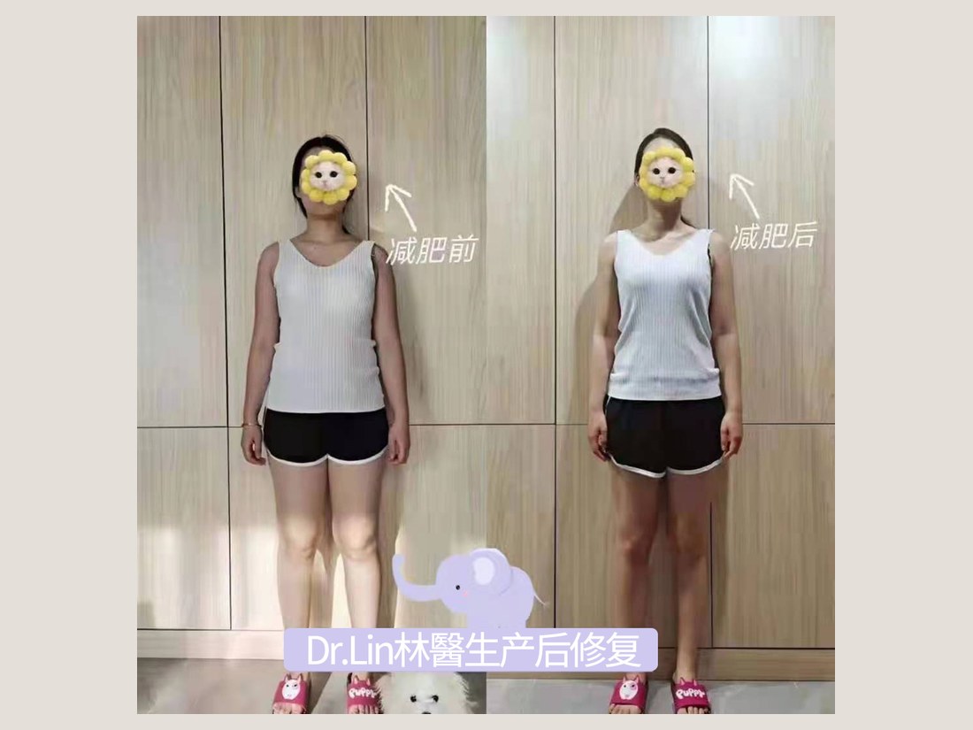 身材管理科部客户案例：体重形体管理记录