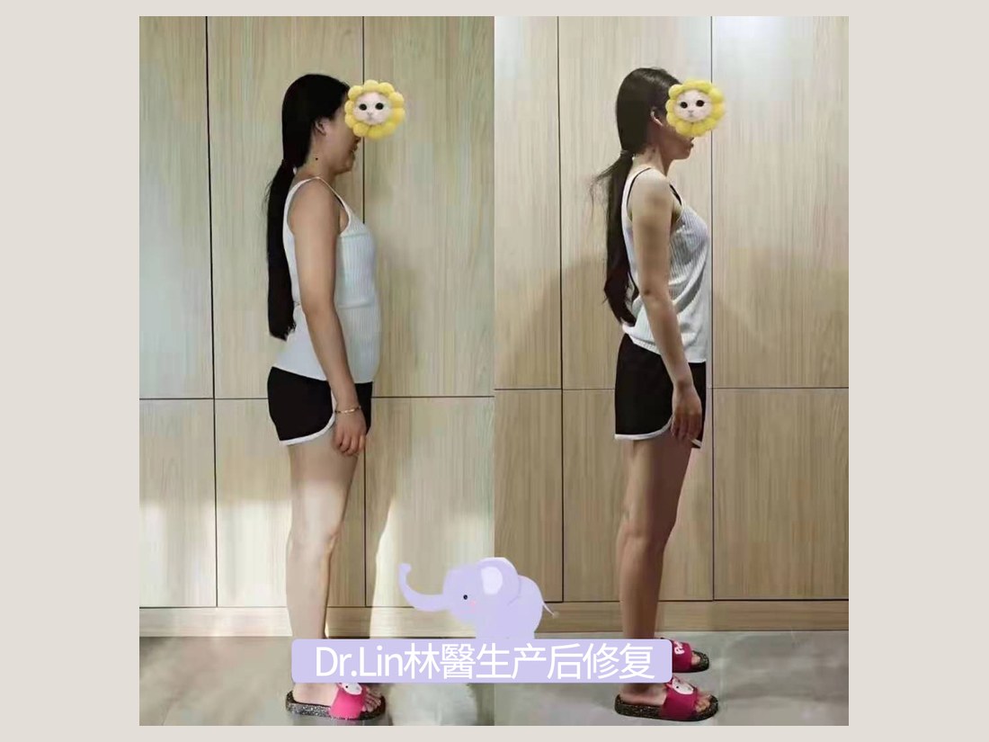身材管理科部客户案例：体态管理记录