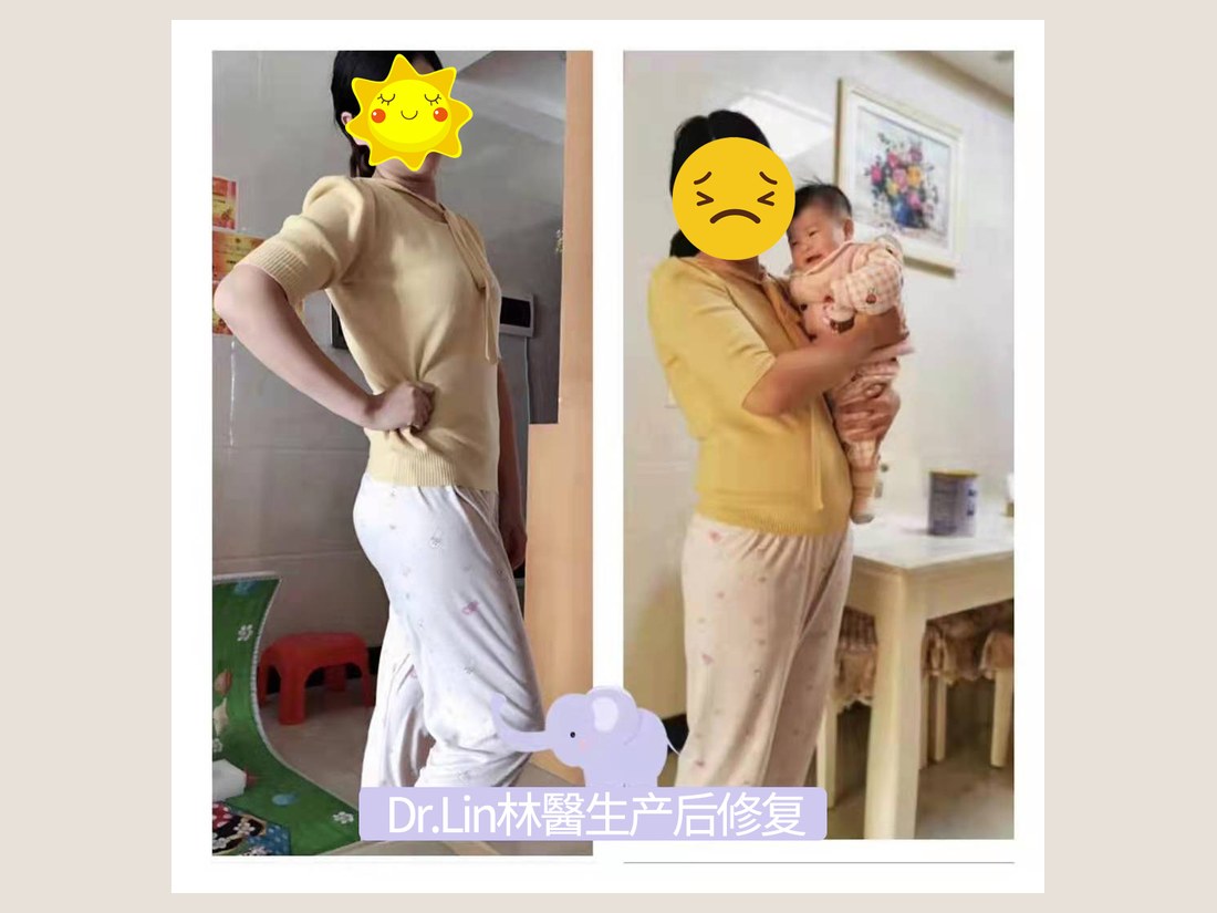 身材管理科部客户案例：体态管理记录
