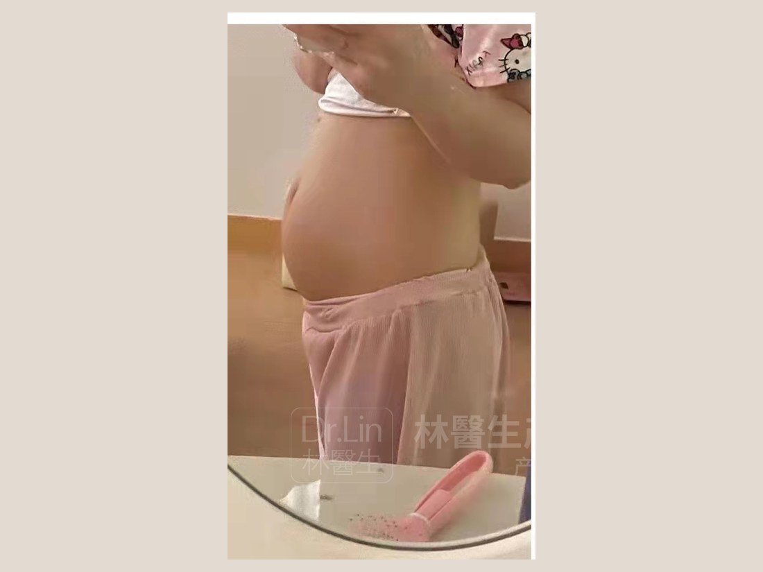 身材管理科部客户案例：腰腹状态实拍