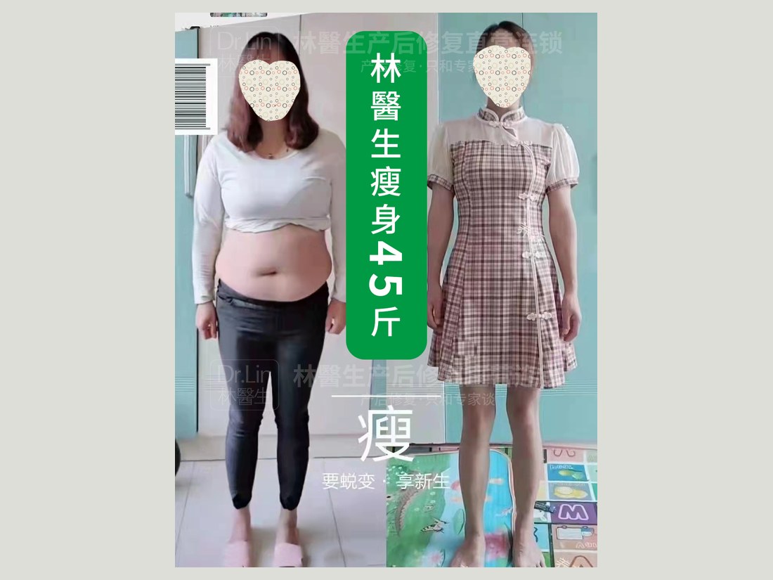 身材管理科部客户案例：瘦身 45 斤