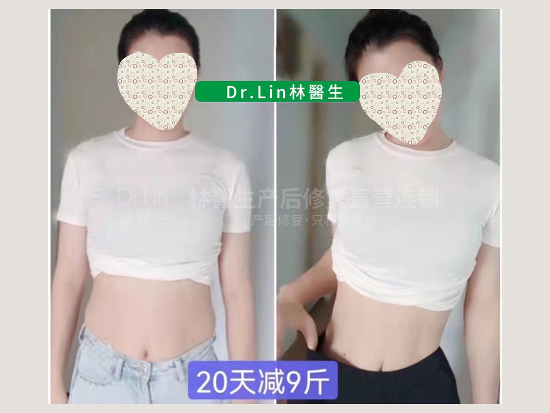 身材管理科部客户案例：20 天减 9 斤