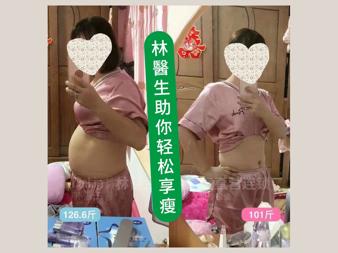 身材管理科部客户案例：轻松享瘦对照